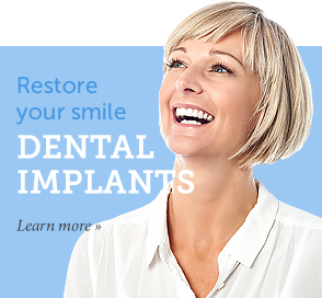 Dental Implants